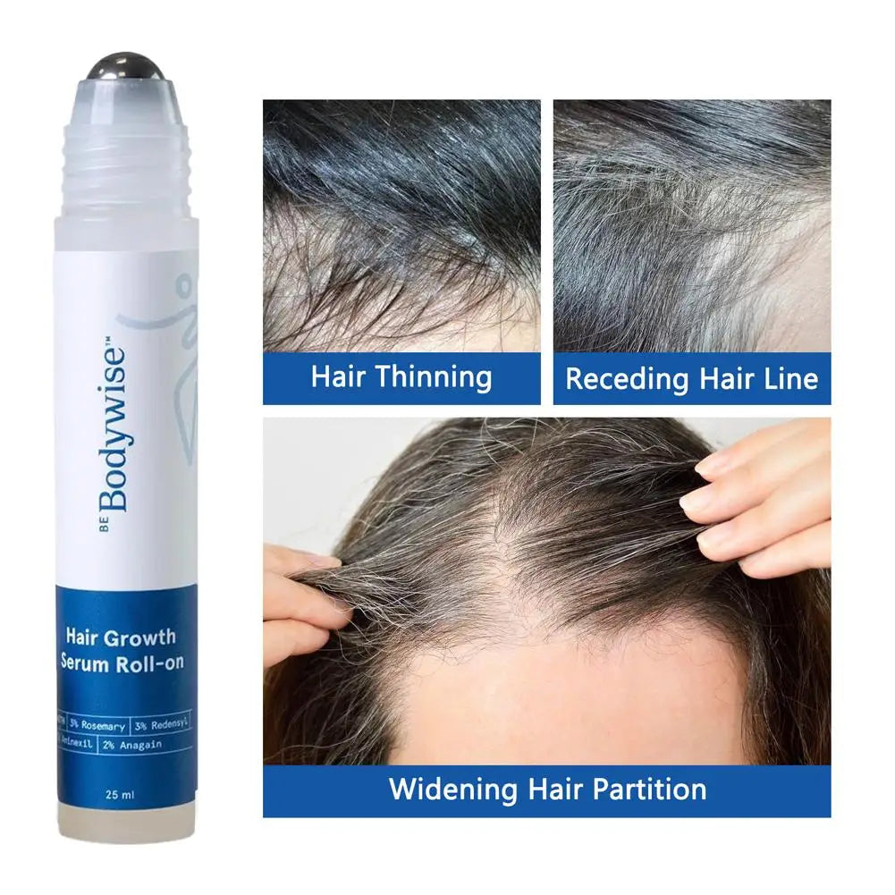 3% Rosemary Hair Growth Essence Oil (25ml) | Scalpsavvy