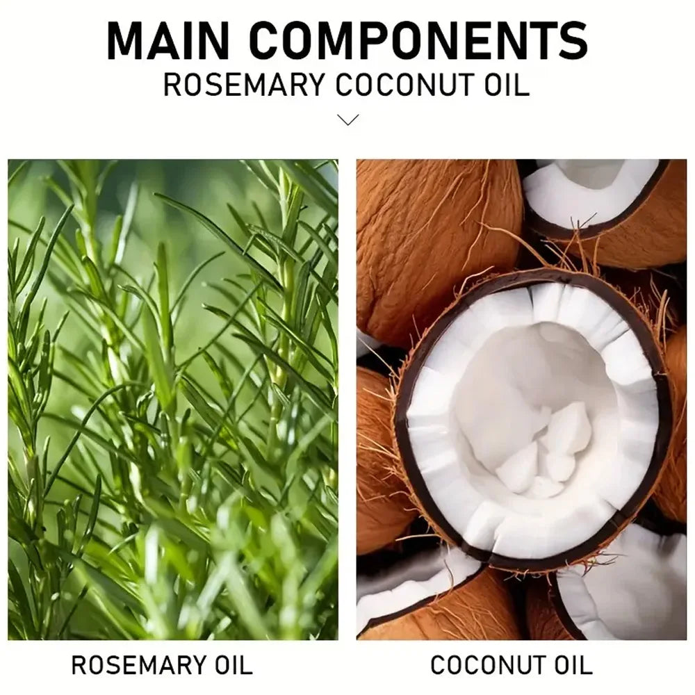 Rosemary & Coconut Scalp & Hair Treatment Oil | Scalpsavvy