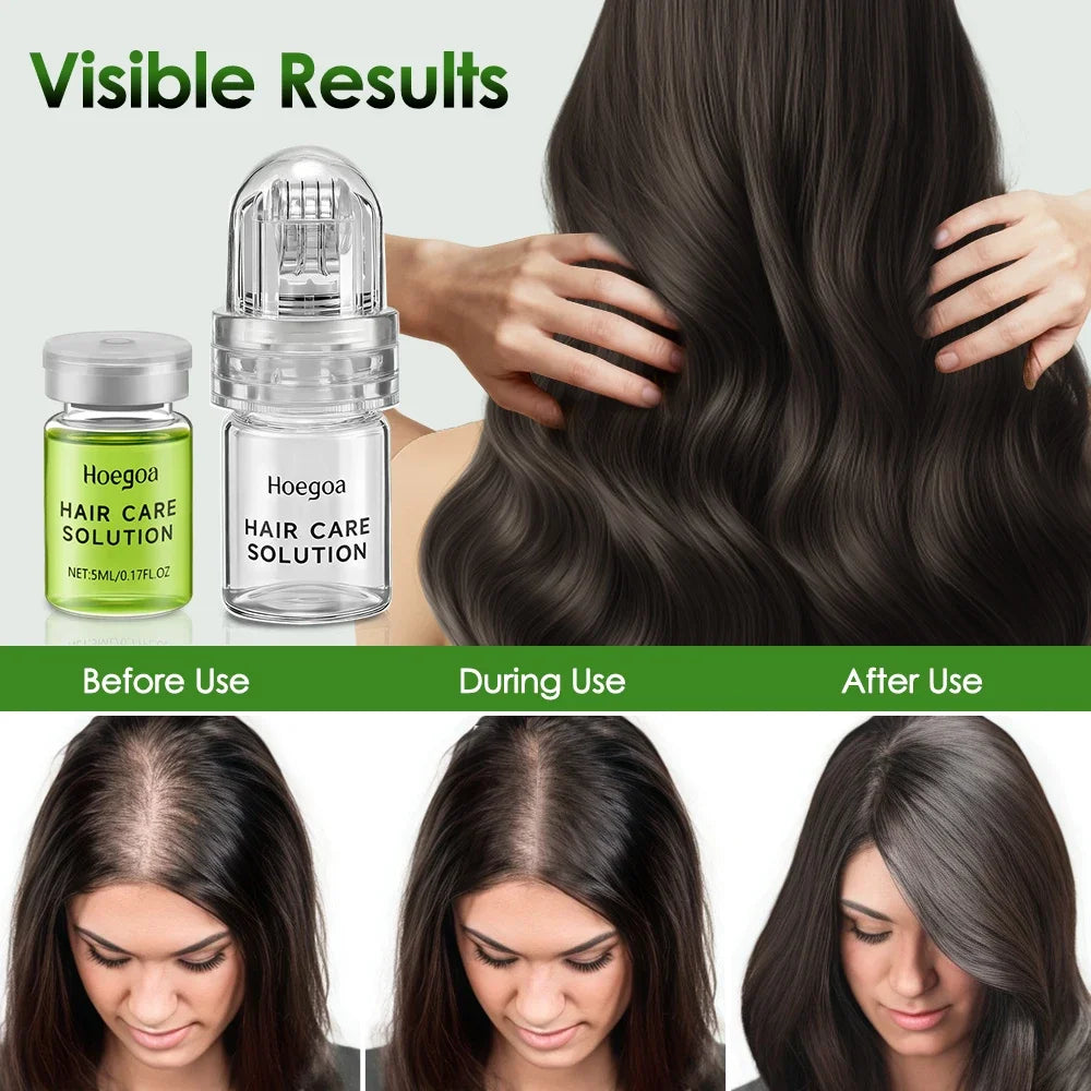 Strengthening Anti-Hair Loss Conditioner Serum | Scalpsavvy