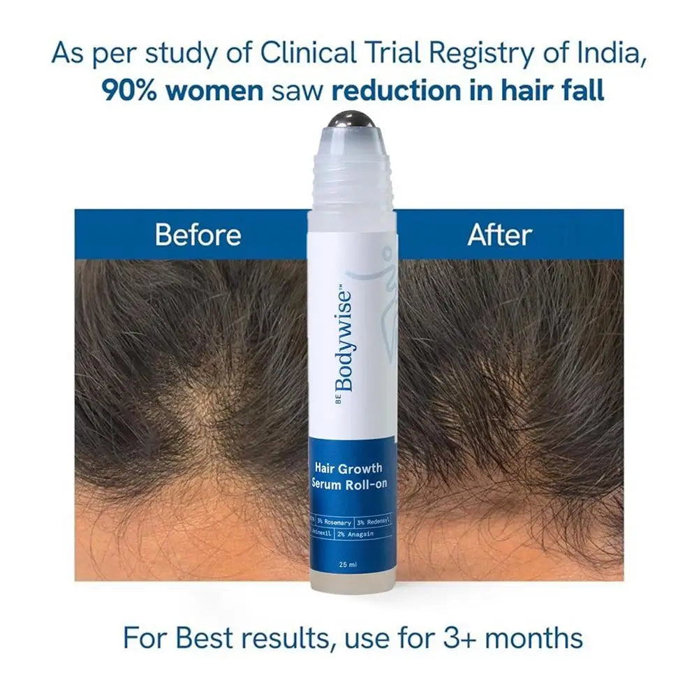 3% Rosemary Hair Growth Essence Oil (25ml) | Scalpsavvy